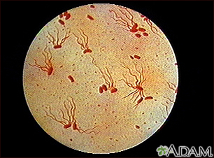 Salmonella typhi organism
