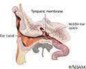 Ear tube insertion - series - Normal anatomy