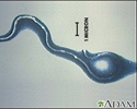Lyme disease organism - Borrelia burgdorferi