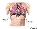 Pneumothorax - series - normal anatomy