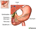 Endoscopic retrograde cholangio pancreatography (ERCP) - series
