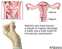 The wet mount vaginitis test