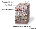 Hair follicle sebaceous gland