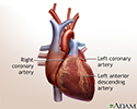 Heart bypass surgery - series - Normal anatomy