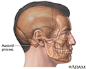 Mastoidectomy - series - Normal anatomy