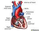 Normal heart anatomy (cut section)