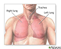 Normal lung anatomy