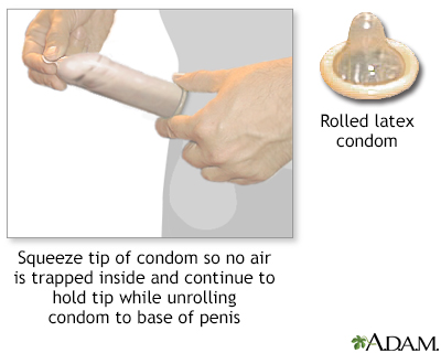 The male condom