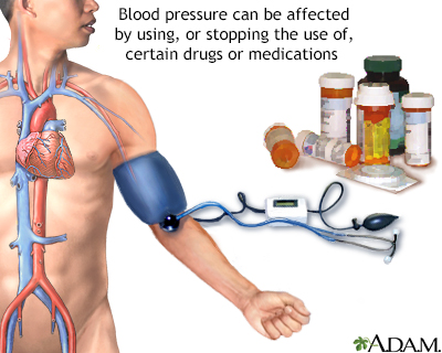 Drug induced hypertension