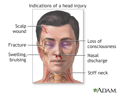 Indications of head injury