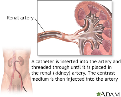Renal arteries