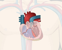 Congenital heart defects (CHD) - Blood flow