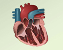 Ventricular fibrillation and tachycardia